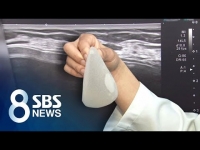[SBS] '희귀암 유발' 가슴 성형 보형물 11만 개 유통..불안 확산