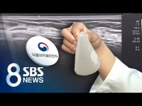 [SBS] 유방 보형물 이식 후 희귀암…국내 40대 환자 첫 보고